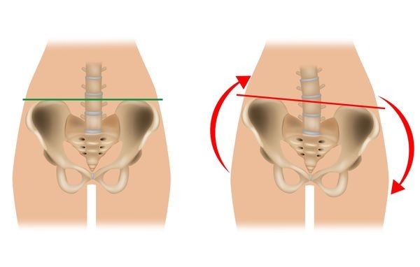 Vital Connection Chiropractic Facebook ad: Breakthrough Sciatica Relief!