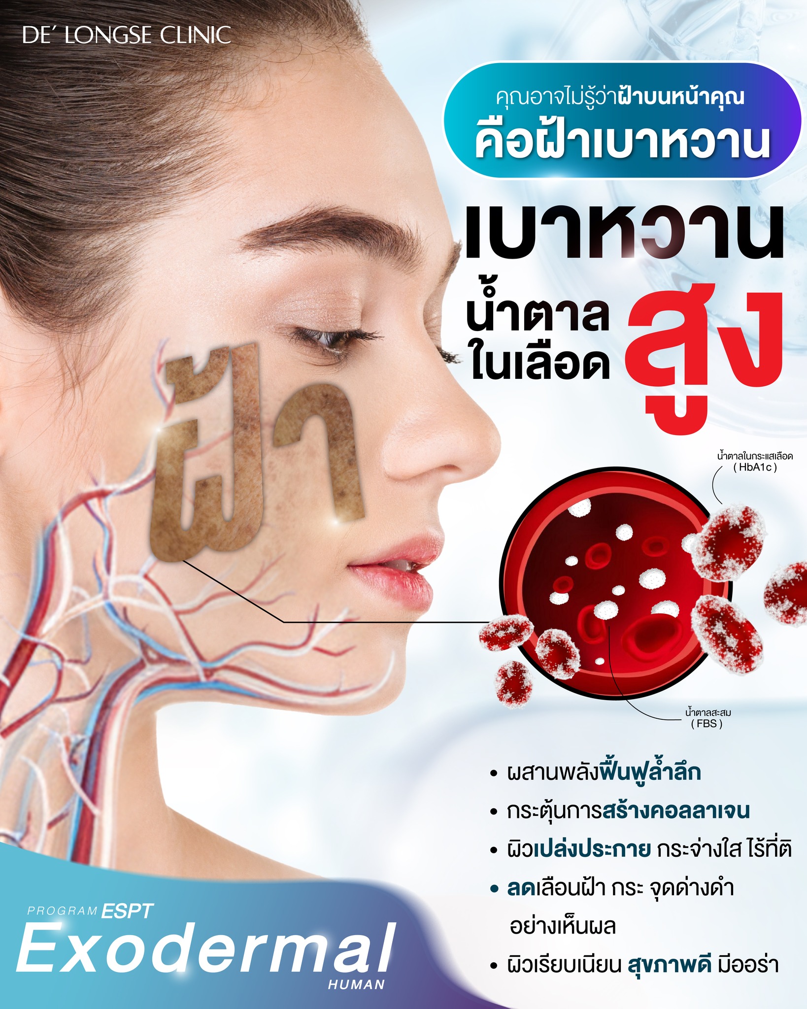 De' Logse Clinic คลินิกแพทย์ผิวหนังอโศก สาขา เอสพลานาด - แคราย Facebook ad: คุณอาจไม่รู้ตัวว่า ฝ้าที่คุณเป็นอยู่เกิดจากน้ำตาลในเลือดสูง…