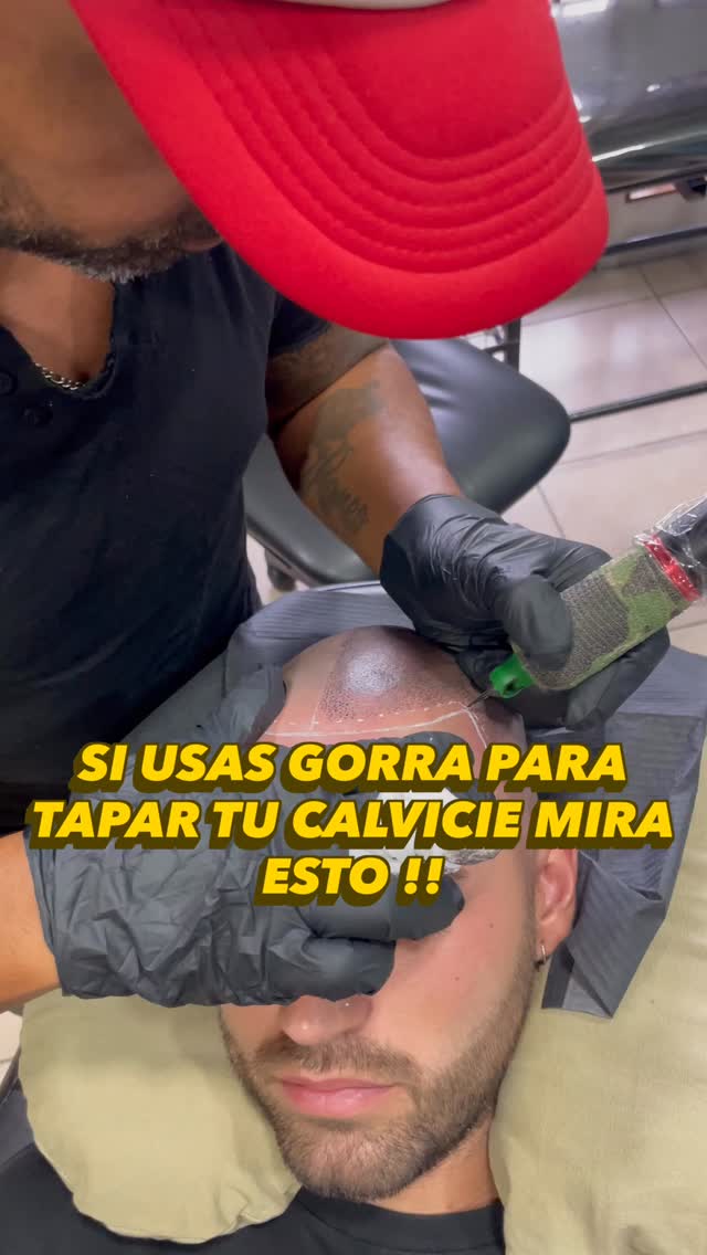 EZE microscalp Facebook ad: ¿Hace cuánto no salís sin gorra?