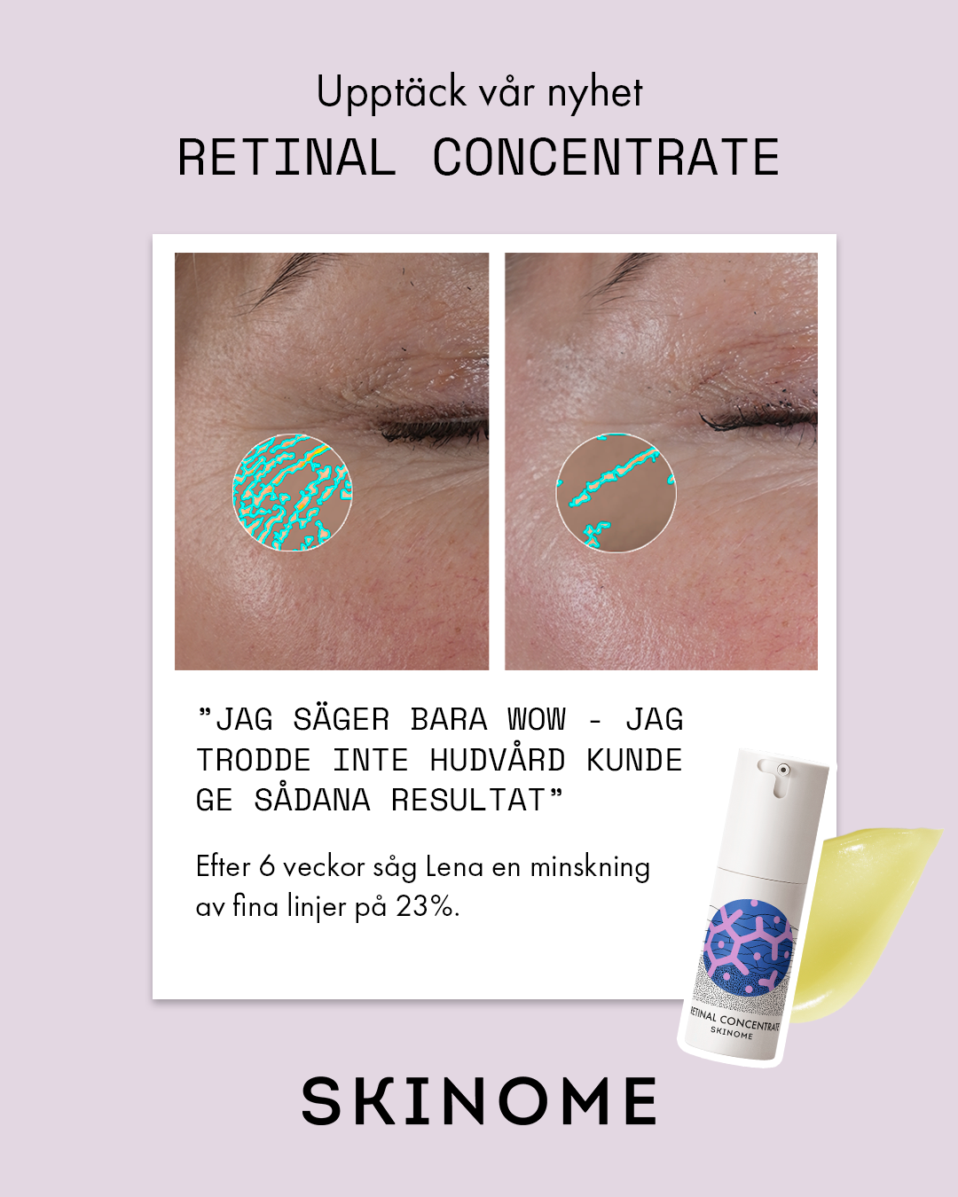 Skinome Facebook ad