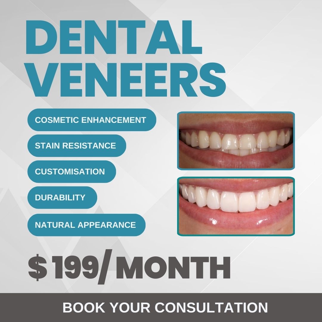 Nashville Aesthetics & Implants Facebook ad: Dental Veneers - FREE Consultation