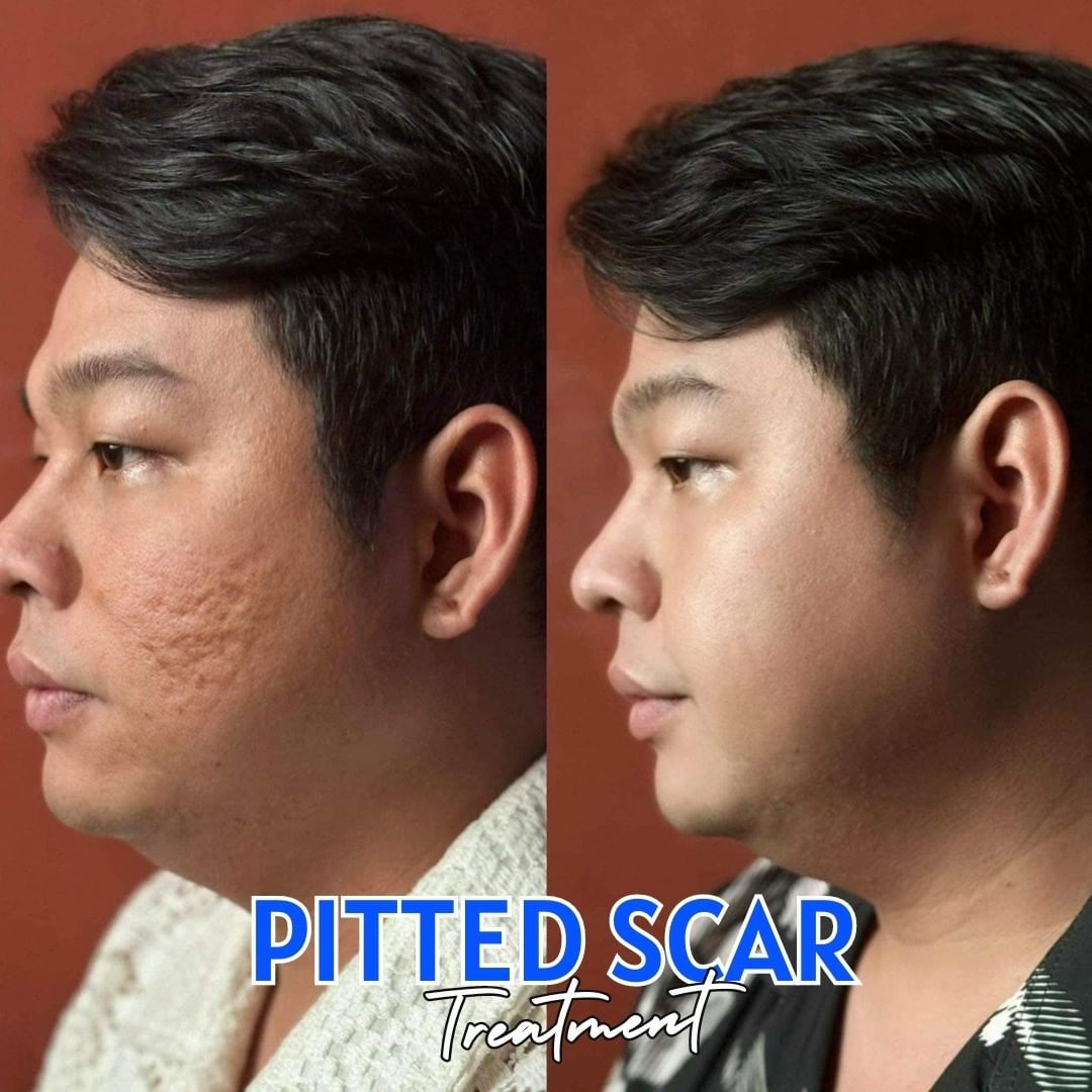 Nado Clinic Davao Facebook ad