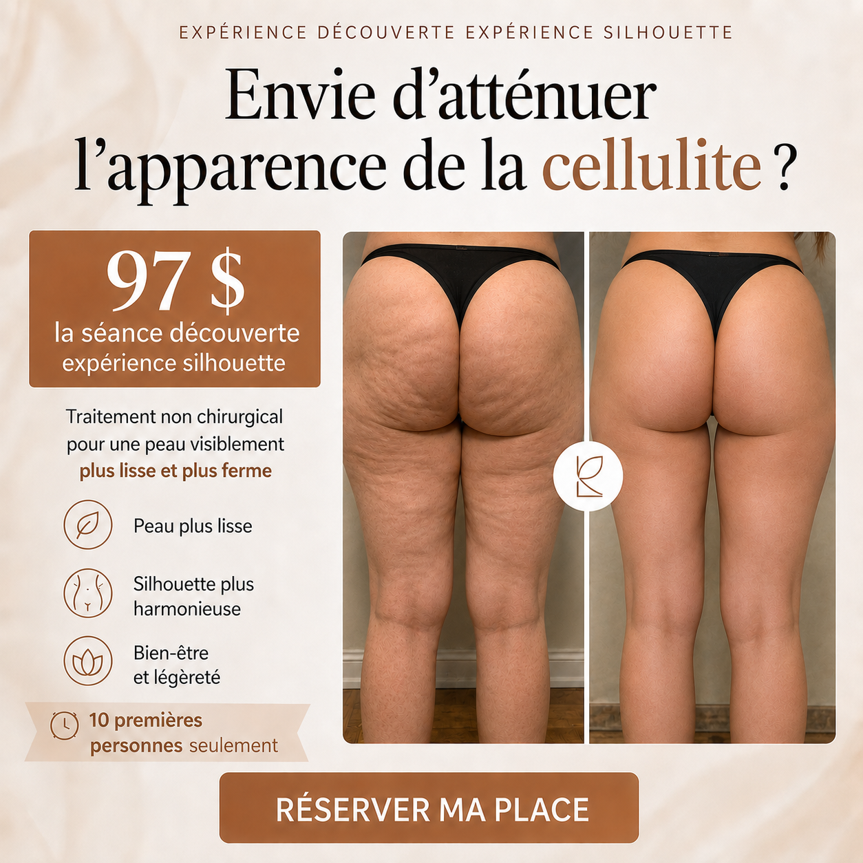 Ekinøxe Esthétique Spécialisée Facebook ad: Endermologie à 97 $