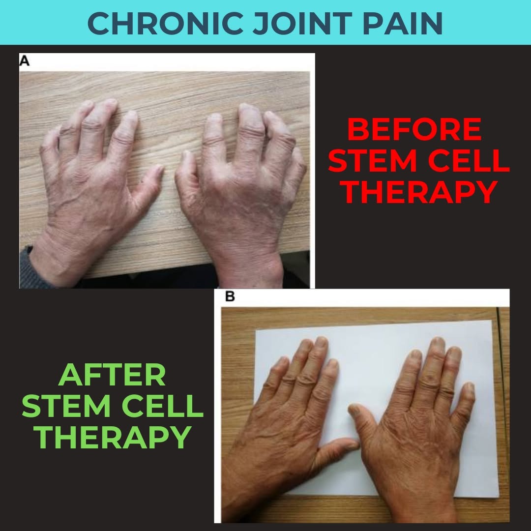 Integrated Pain Specialists Facebook ad: Avoid Surgery, New Pain Relief in Utah!
