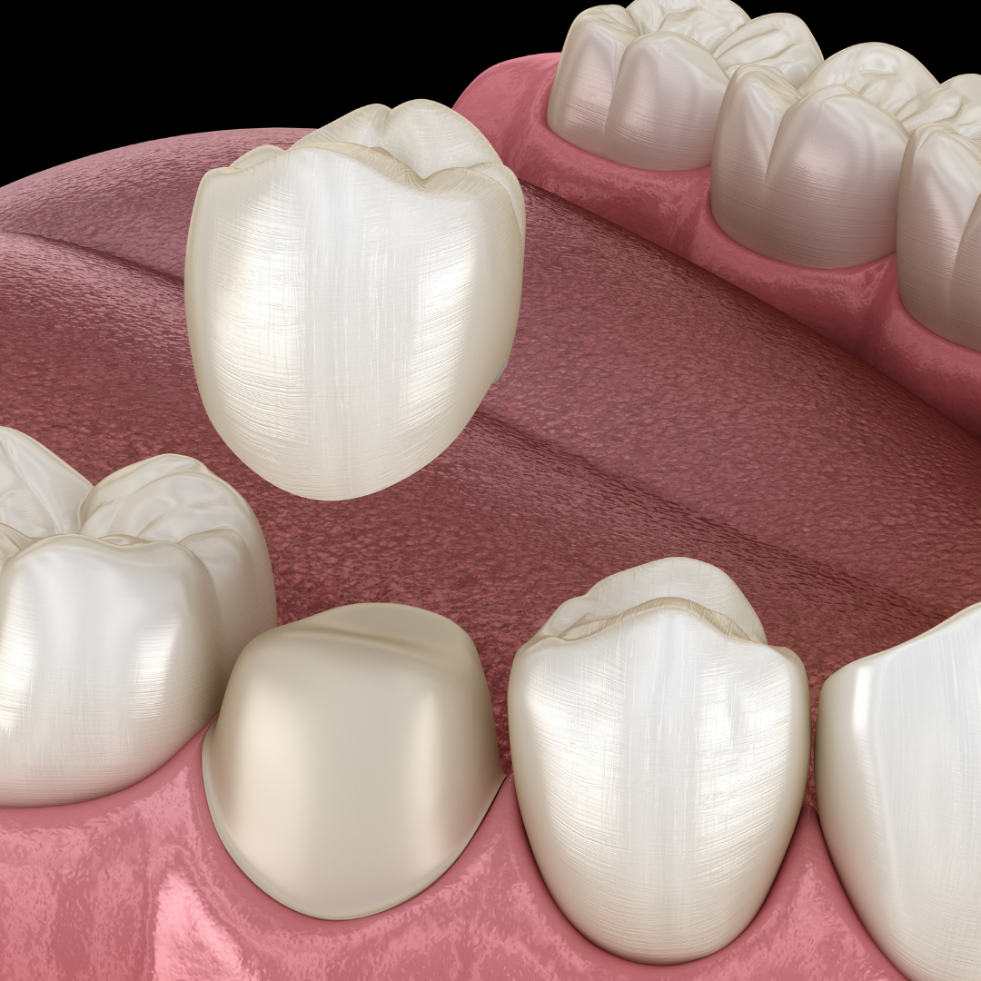 Optimum Dental of Elgin Facebook ad