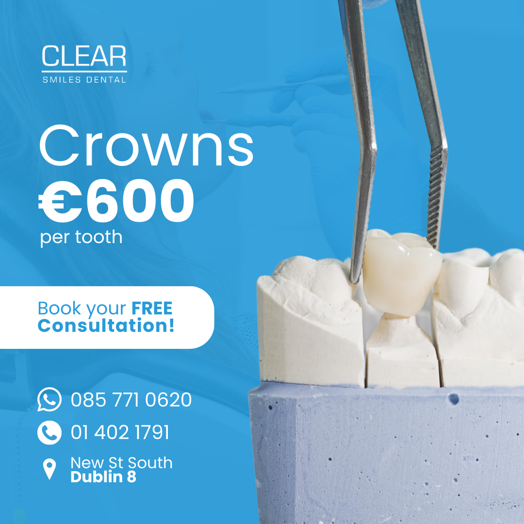 Clear Smiles Dental Facebook ad