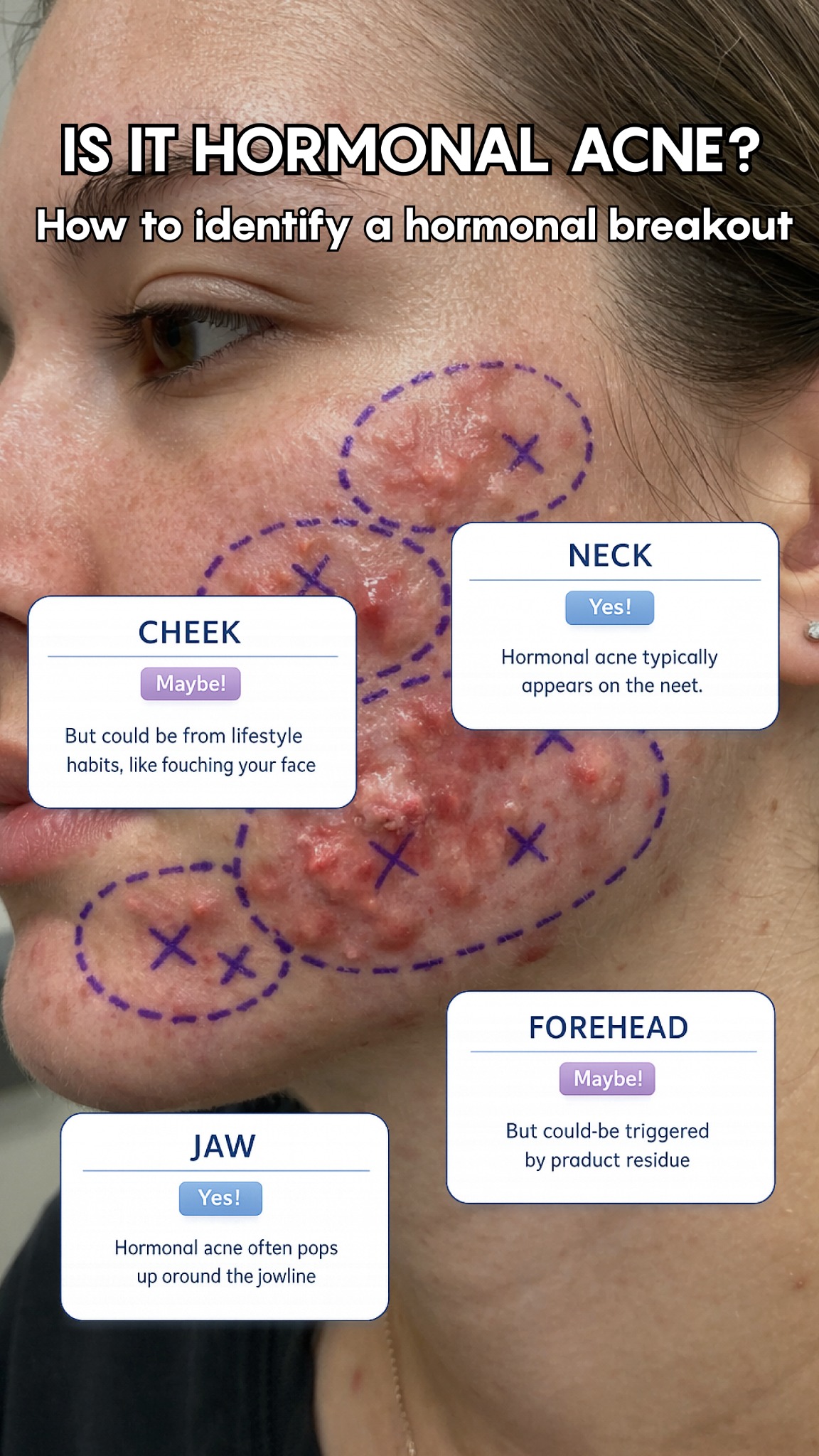Anne's Skincare Blog Facebook ad