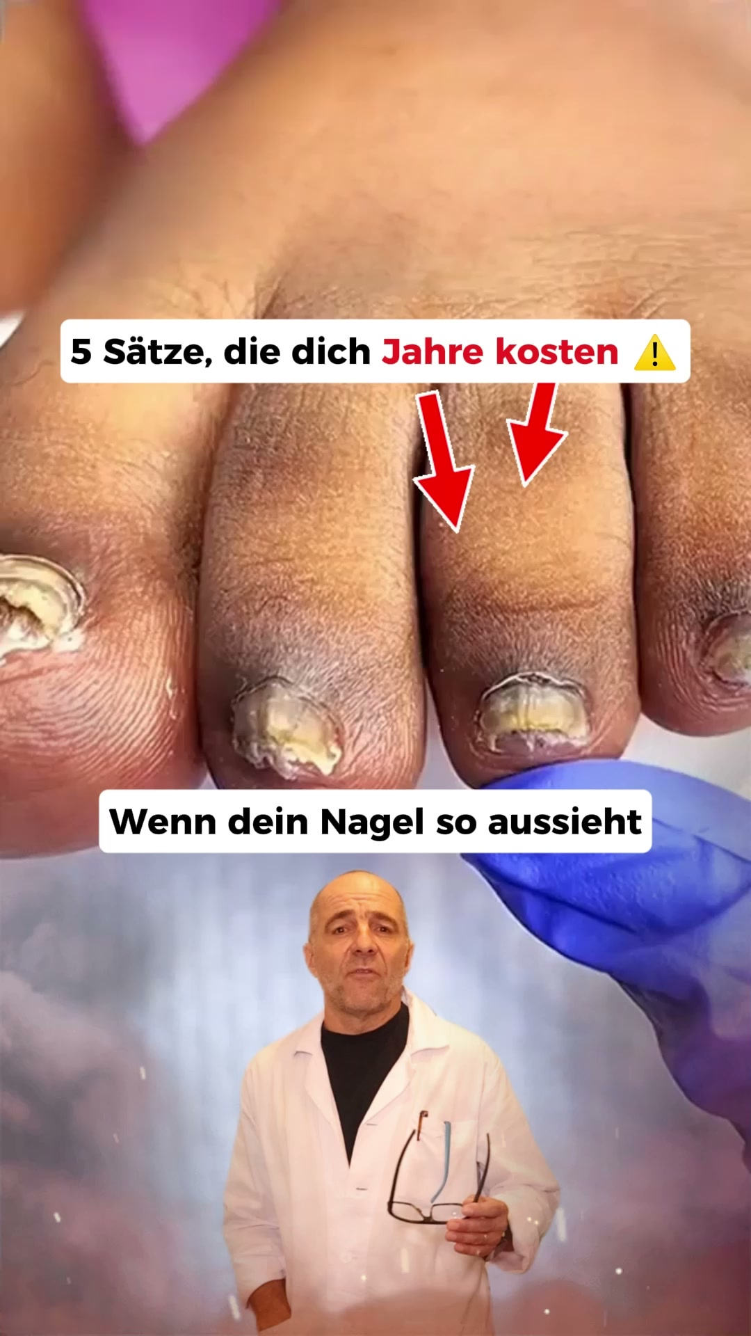Nagelpilz Ratgeber Facebook ad: Der größte Fehler bei Nagelpilz