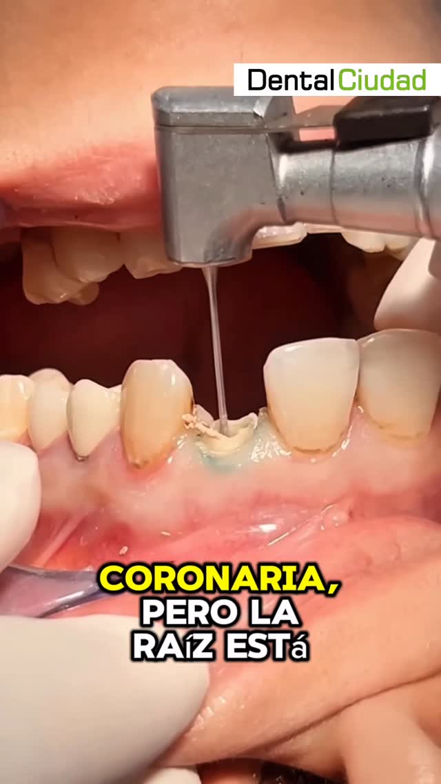 Dental Ciudad 1 Facebook ad: Chatea con nosotros, Nuestros Servicios: Restauraciones…