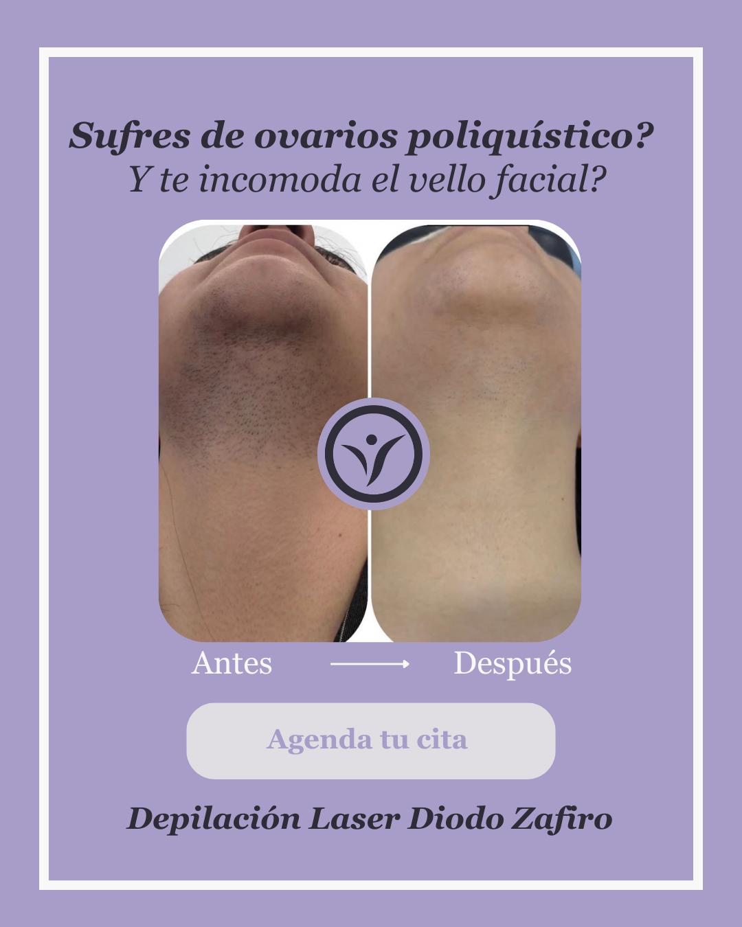 Vivor Estetica Facebook ad