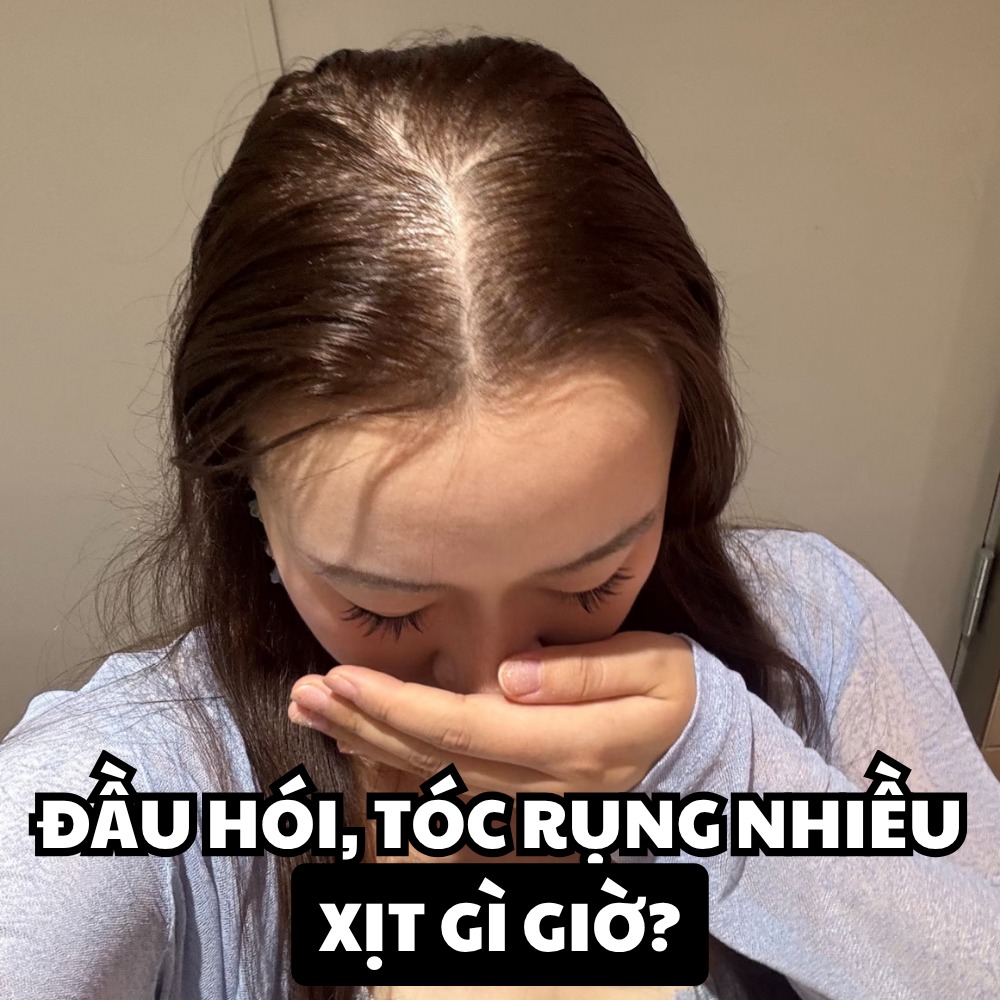 Kiếp nạn Skincare Facebook ad