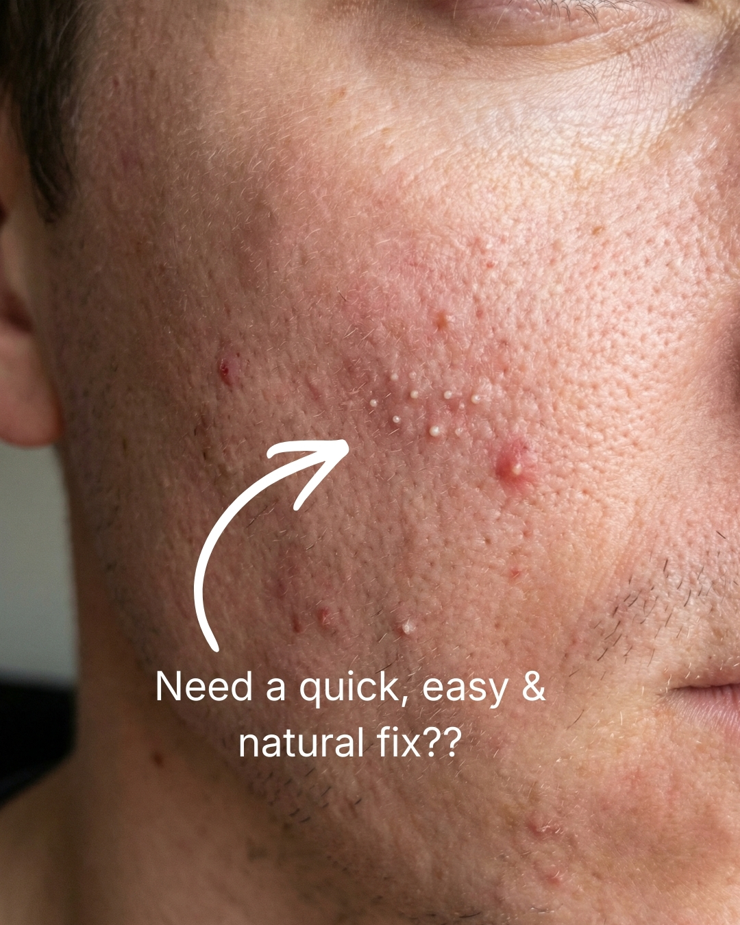 Frasé Skin Facebook ad