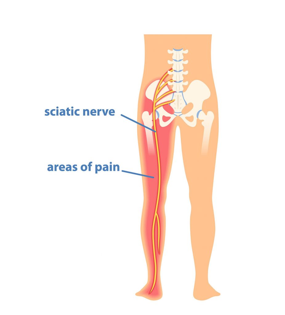 Vital Connection Chiropractic Facebook ad: Precision Chiropractic Care for Professionals Ready to…