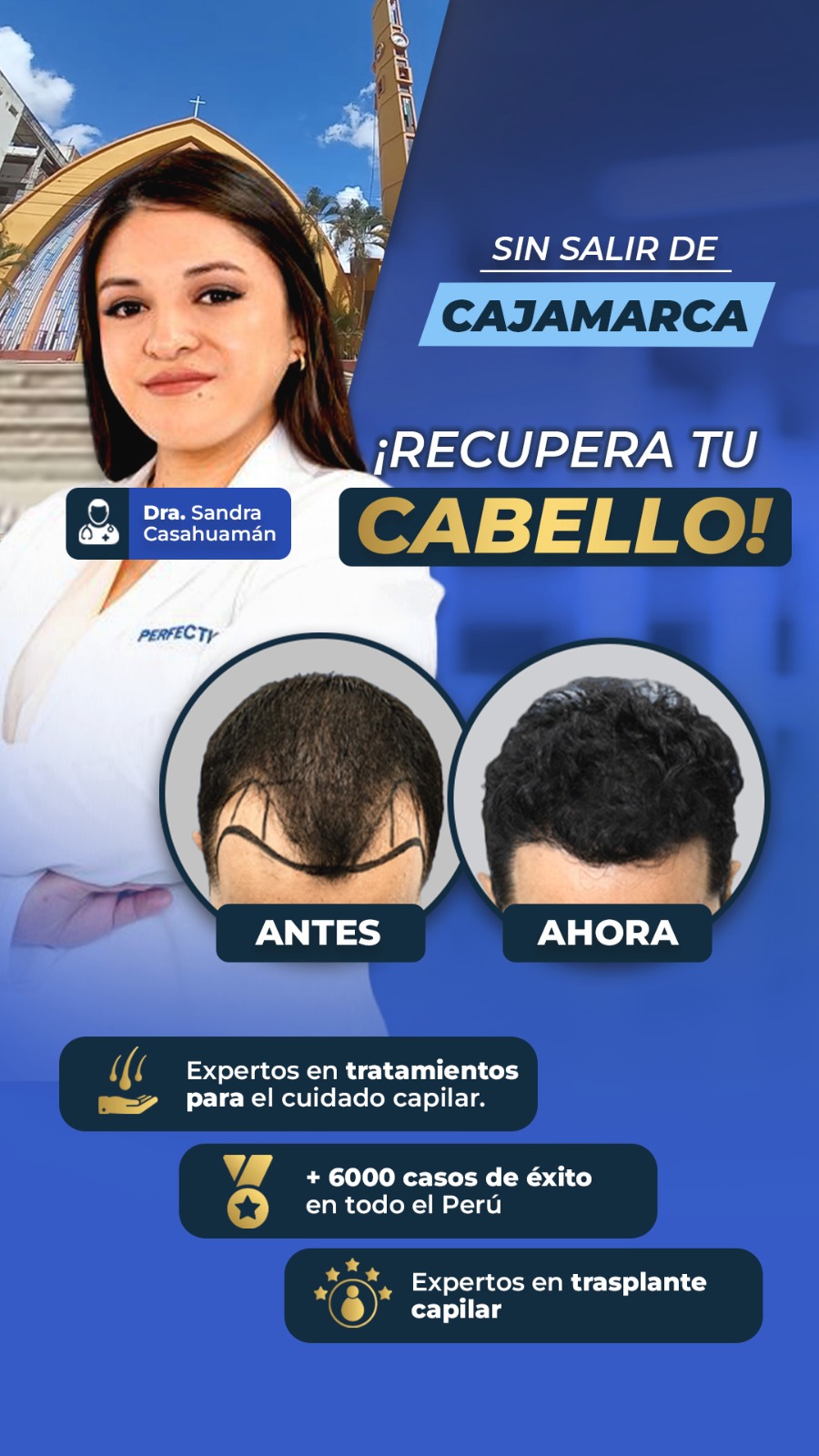 Perfection capilar - Trasplante capilar Facebook ad from Mar 2, 2026