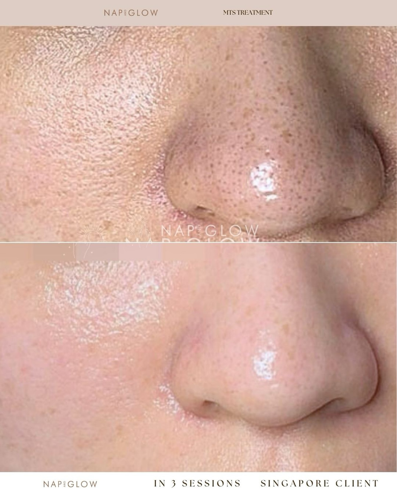 Lashup_sg Facebook ad: This client came to us, concerned about uneven…