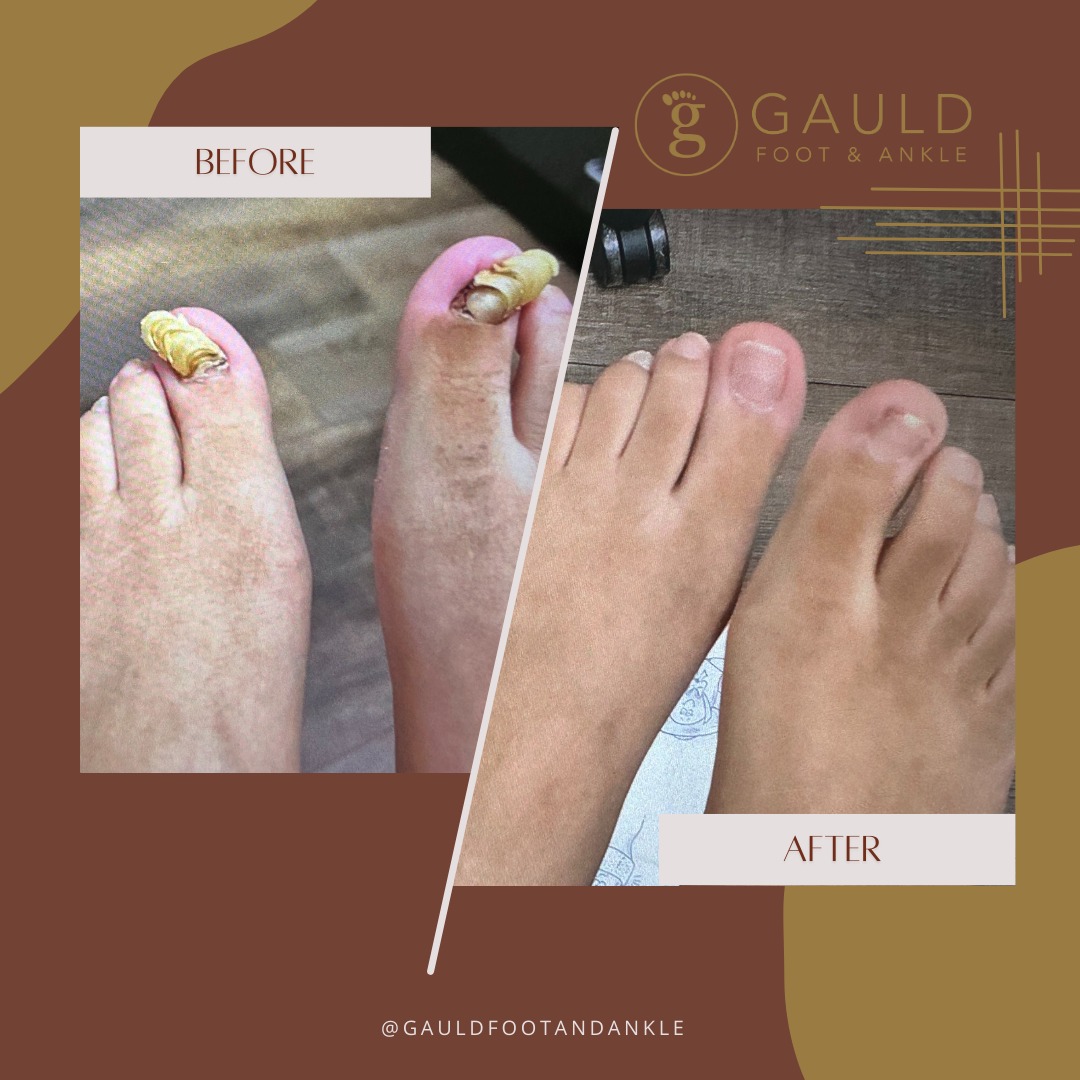 Gauld Foot & Ankle Facebook ad: Book an appointment