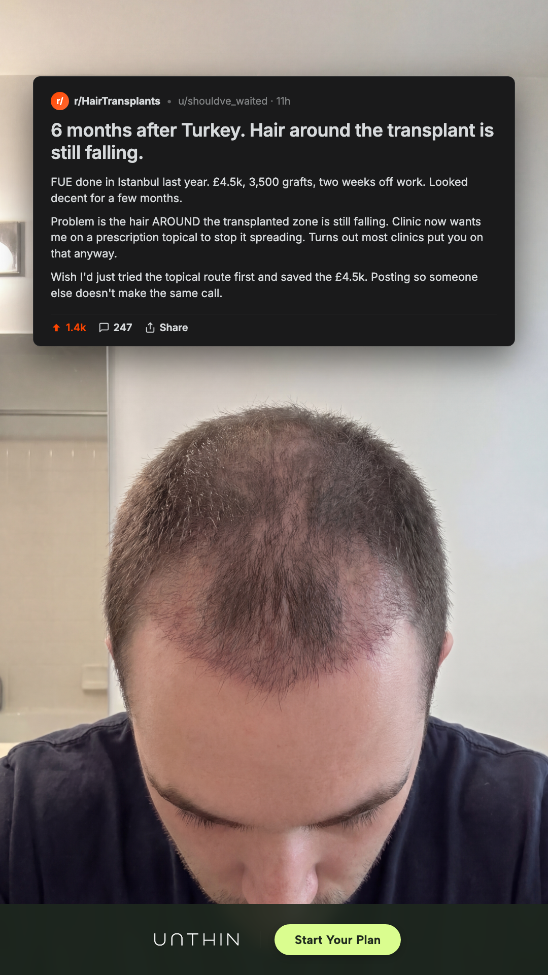 Unthinhair Facebook ad