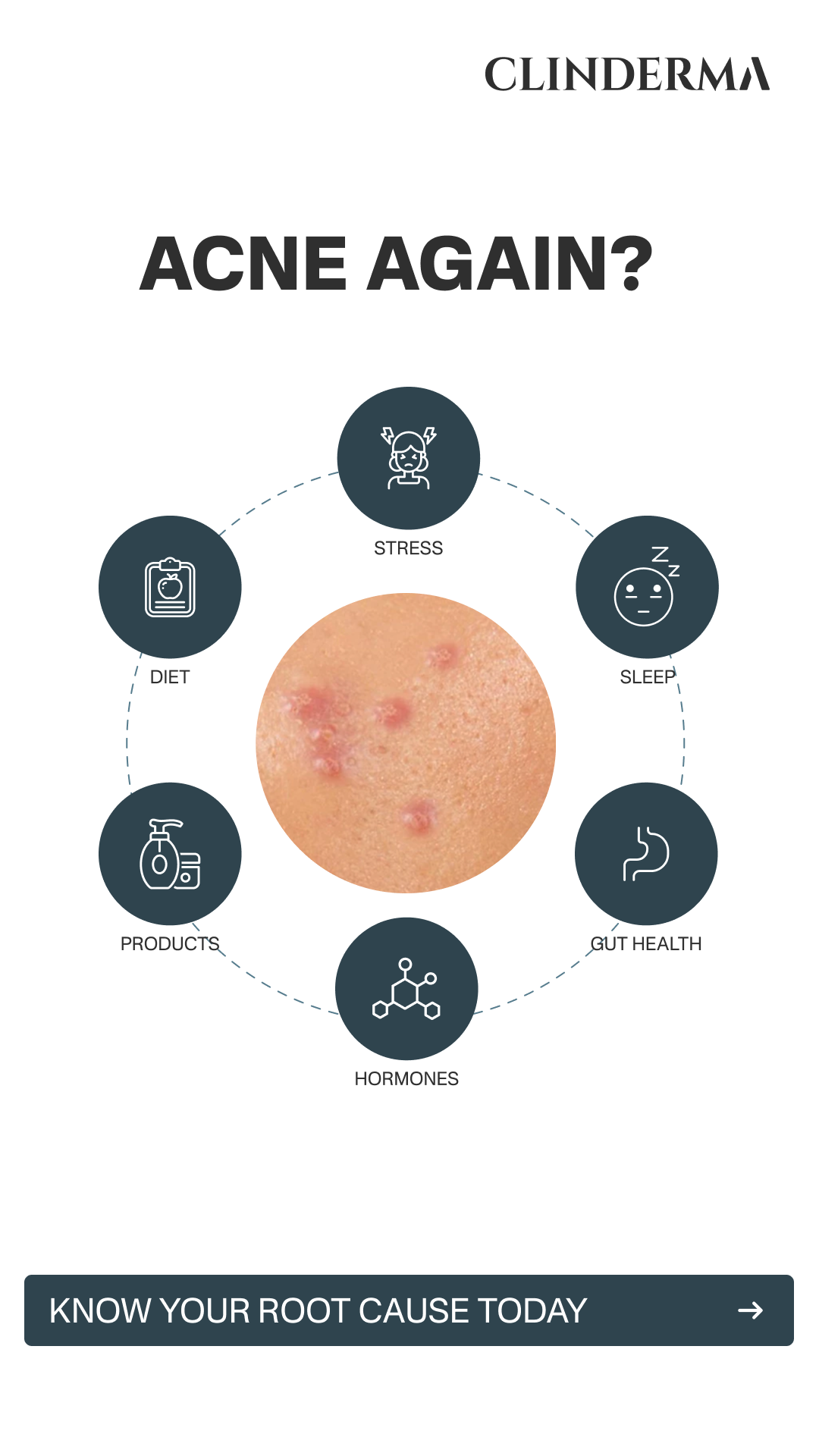 Clinderma India Facebook ad from Feb 11, 2026