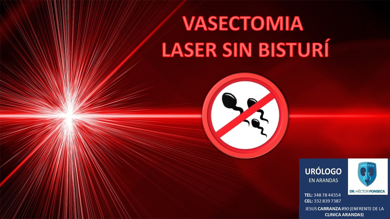 Urologo en Arandas Facebook ad: ¡¡¡YA CONTAMOS CON LA NUEVA VASECTOMIA LASER!