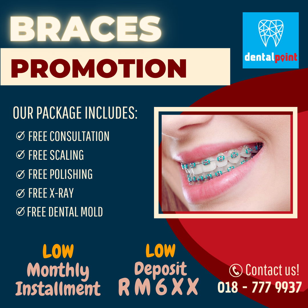 Klinik Pergigian Dentalpoint Kepong Facebook ad: Promosi braces menarik kepada sesiapa yang inginkan…