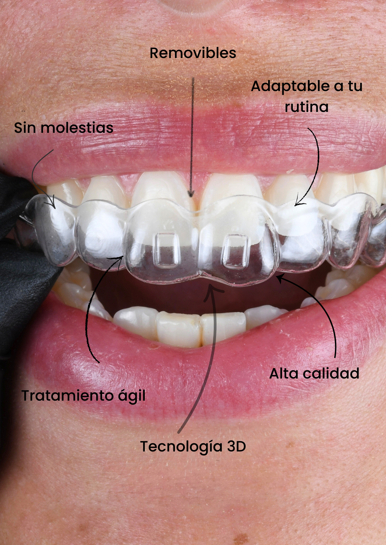 Odonto Devoto Facebook ad: Escribinos HOY Mismo!