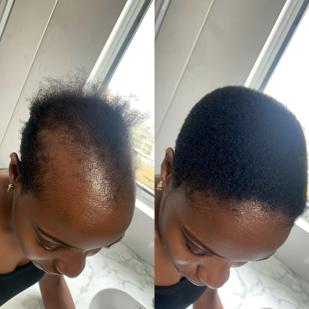 Keisha's Hair Journey Facebook ad