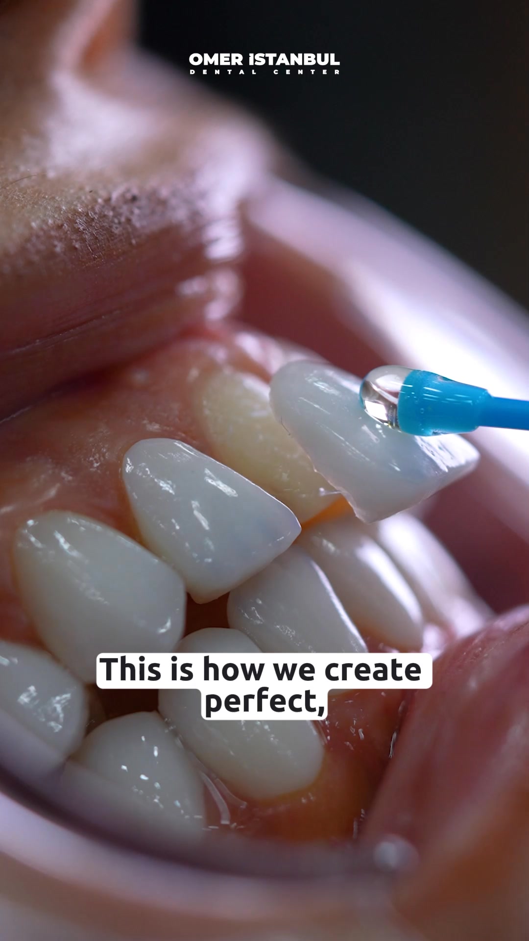 Omer Istanbul Clinic Facebook ad: Affordable Dental Care in Turkey