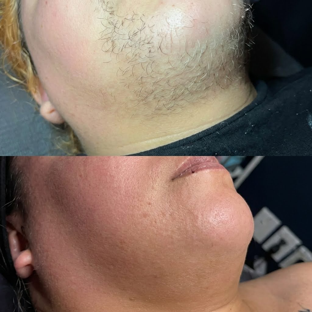 Dr. Hannah Jacob Facebook ad