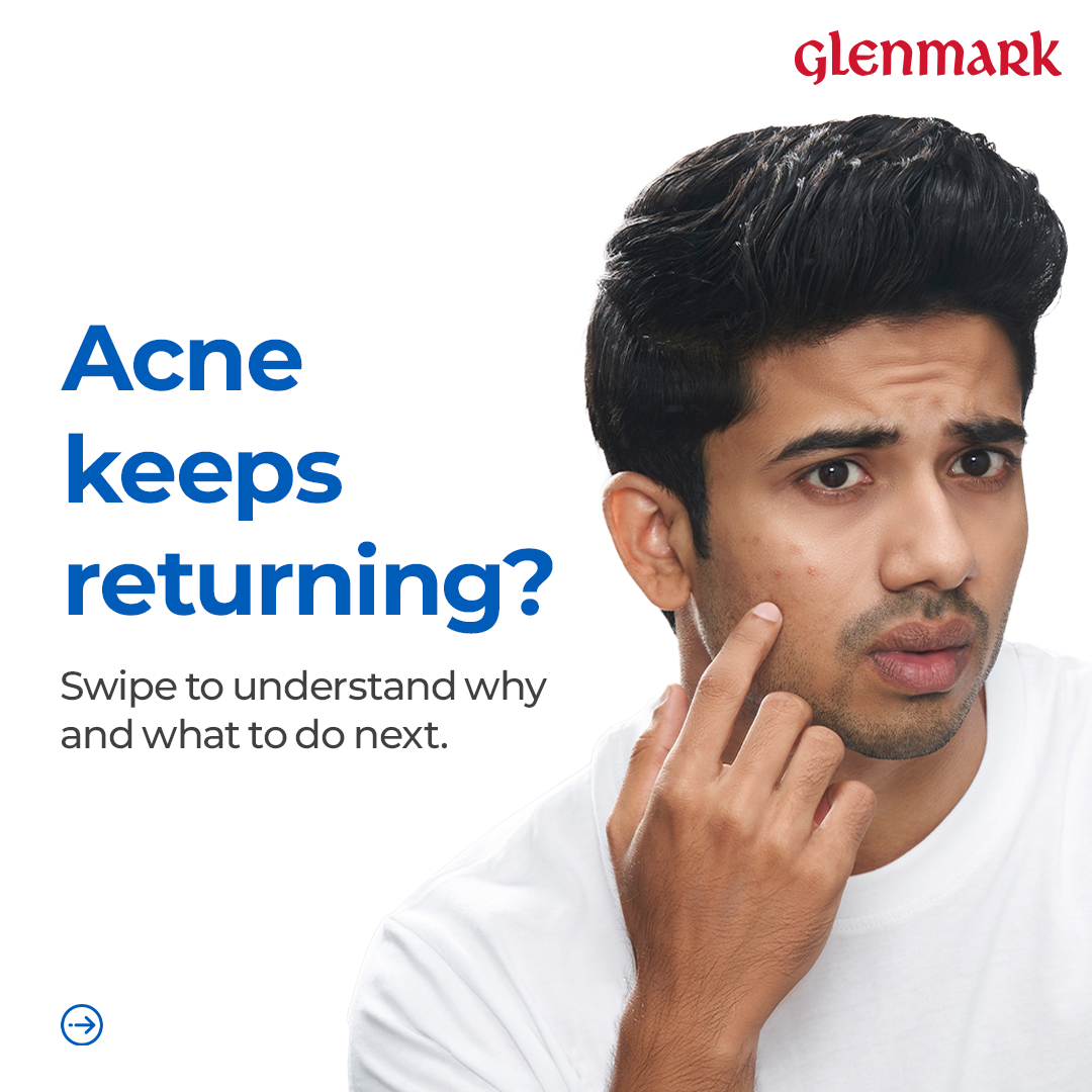 D'Acne by Glenmark Facebook ad: D’Acne Foaming Face Wash targets excess oil and…
