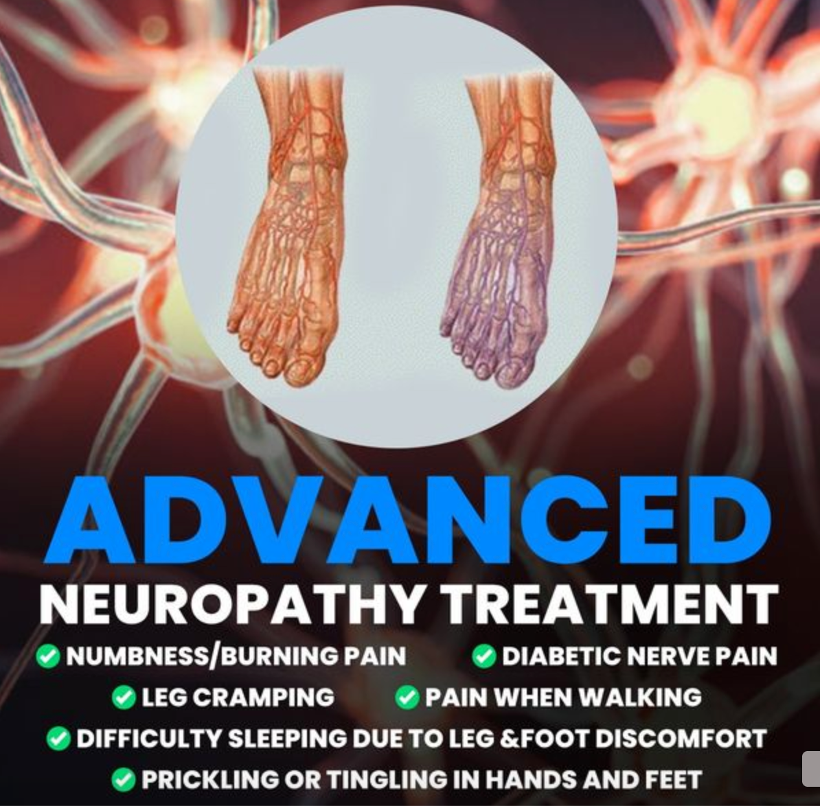 Ontario Disc Centre Facebook ad: Neuropathy Breakthrough Treatment in Windsor