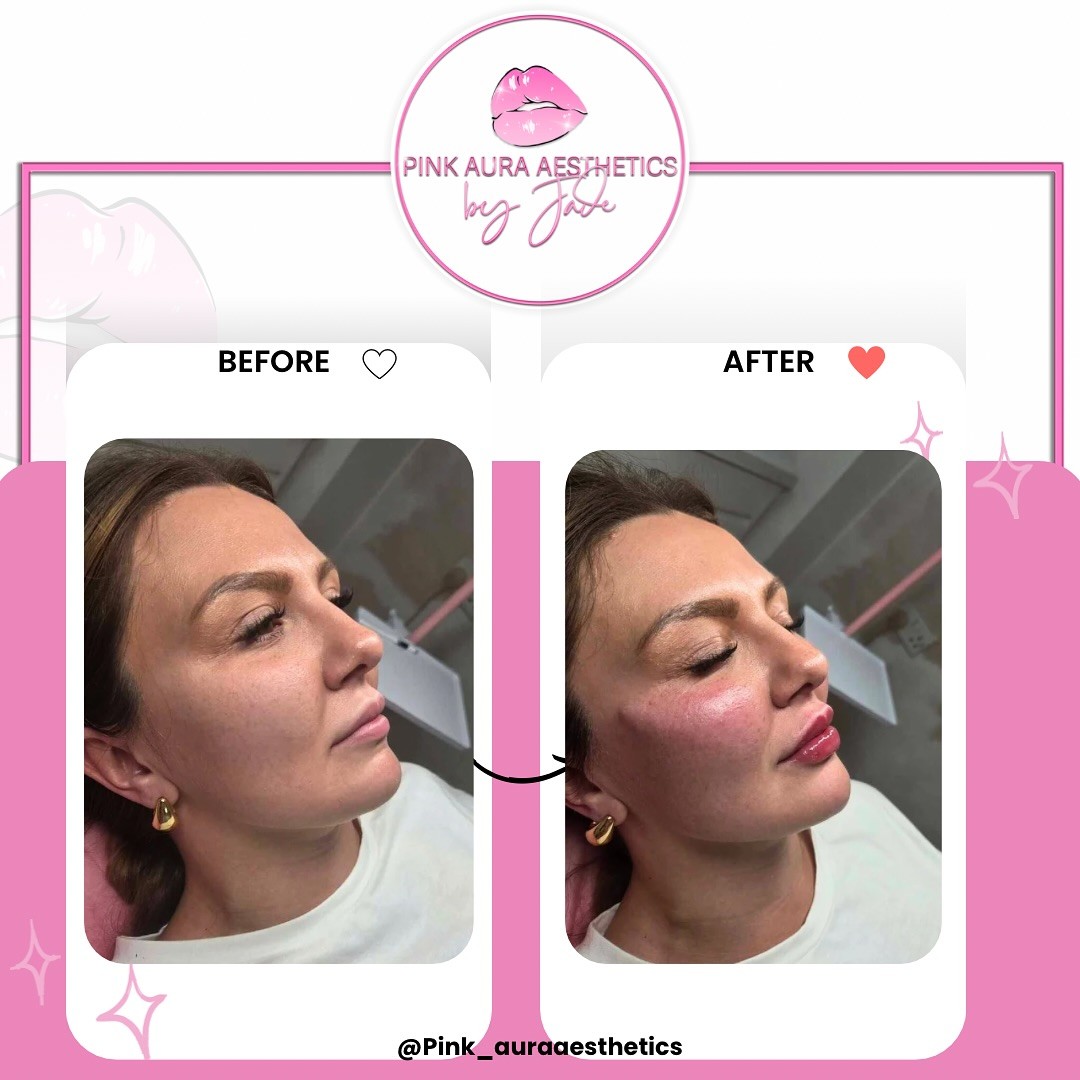 Pink Aura Aesthetics Facebook ad: Chat in Messenger