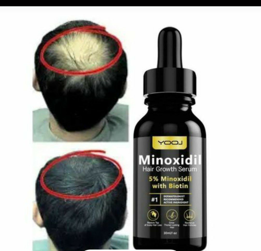 Denyse Beauty & Healthy Care Facebook ad: Minoxidil 5% ikuza umusatsi ku bagabo n'abagore.