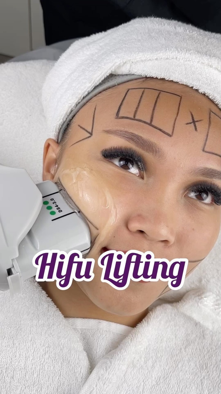 Borneo Medispa Johor Bahru Facebook ad: HIFU LIFTING TREATMENT