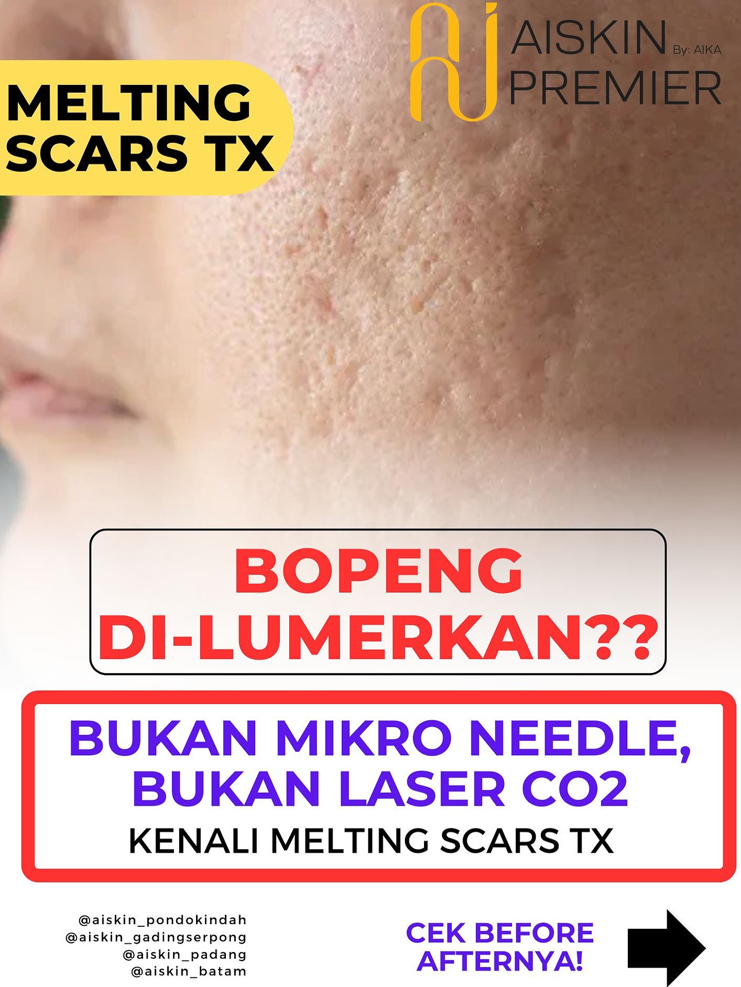 Klinik Kecantikan Aiskin Gading Serpong Facebook ad