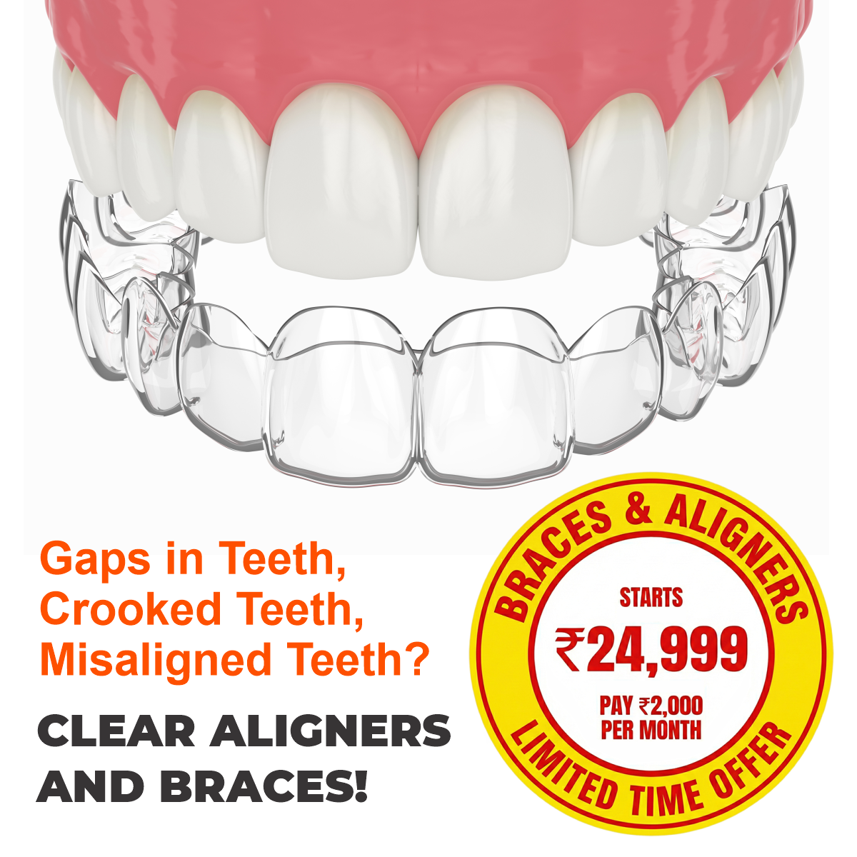 SDalign Facebook ad from Mar 11, 2026