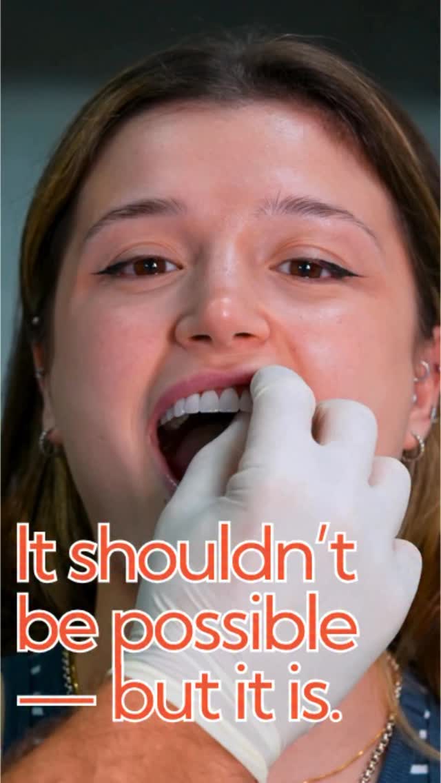 Dental Centre Turkey Facebook ad: Experience the next generation of veneers with DCT…