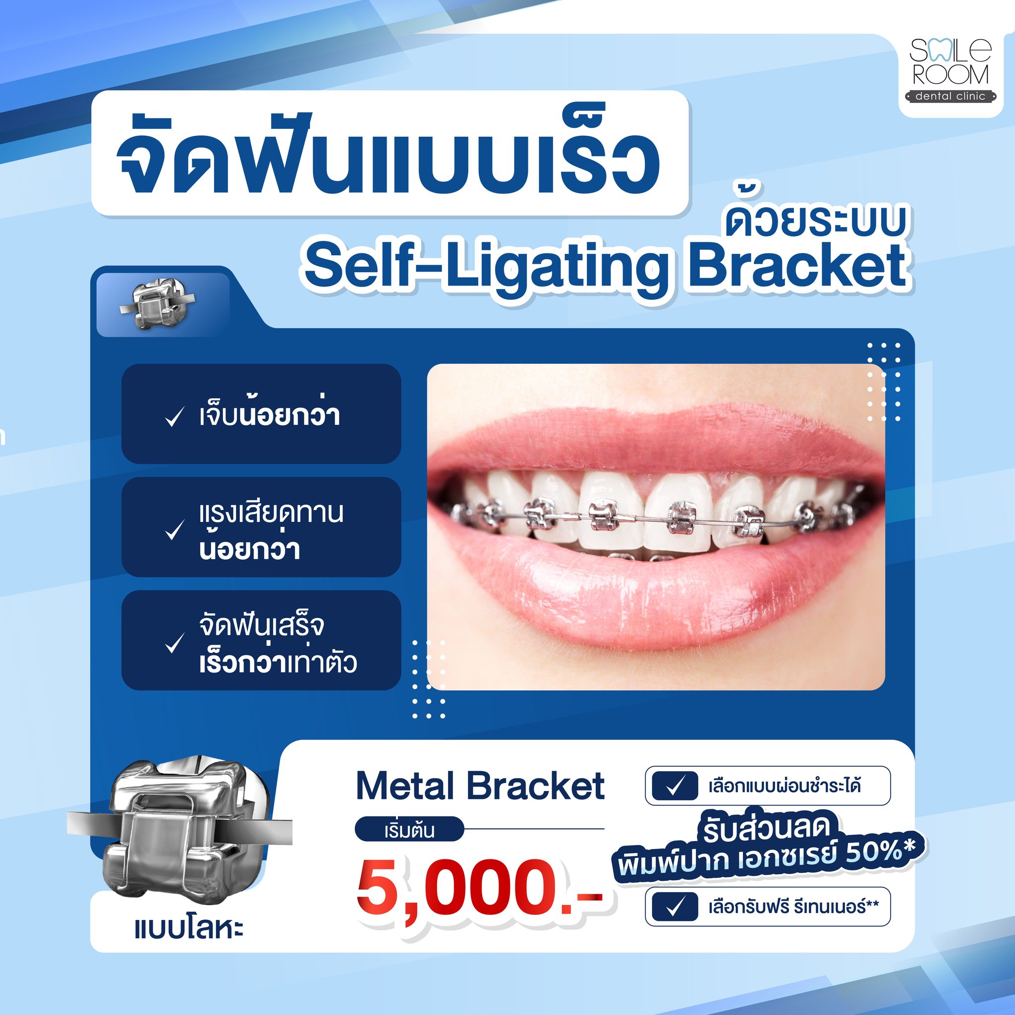 Smile Room Facebook ad