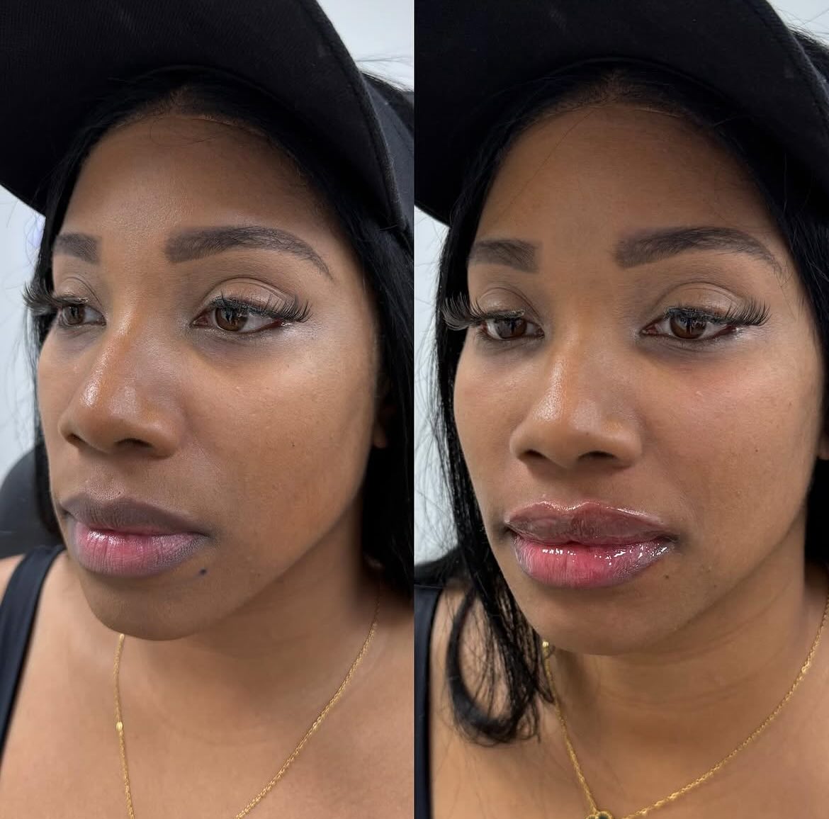 Beauty Health MedSpa Facebook ad: Comment BALANCE for pricing!
