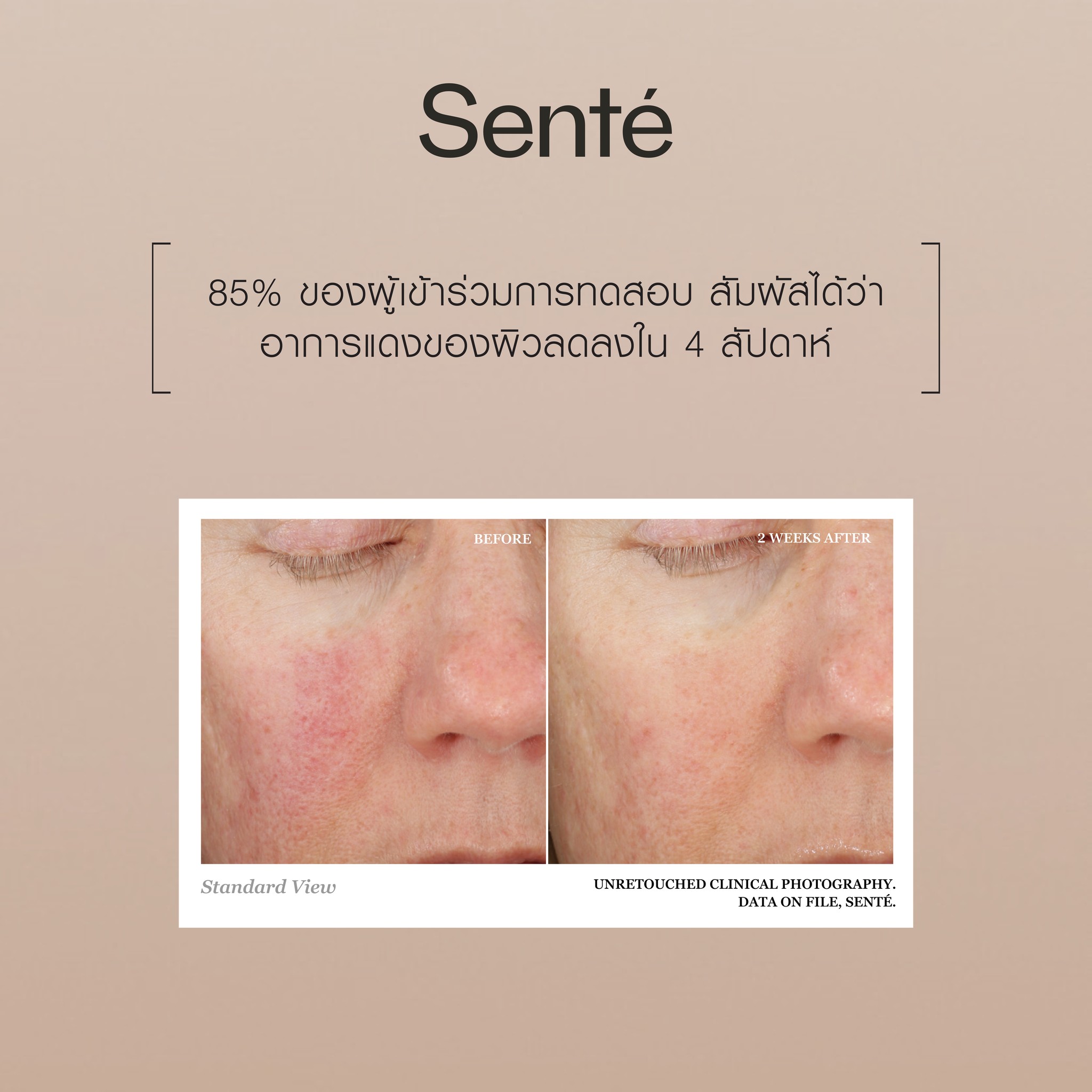 Sente Thailand Facebook ad: ผลิตภัณฑ์ Medical Grade Skincare จากอเมริกา