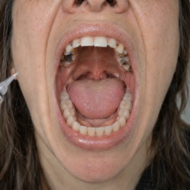 Dr. Emily Carter Shape Care Facebook ad: Dentist-Tested & Recommended | CE Certified Advanced…