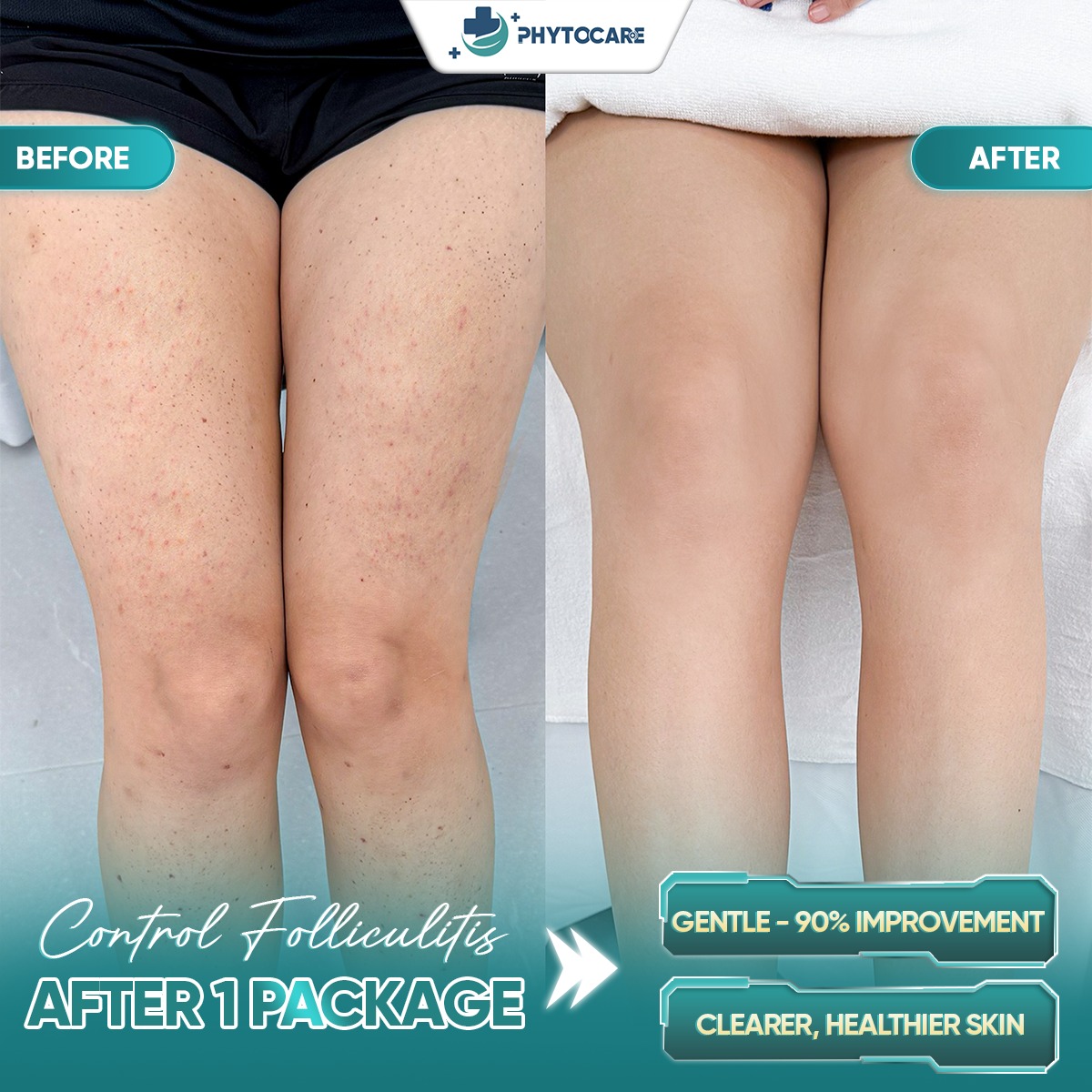 Cebu Phytocare Skin Clinic Facebook ad