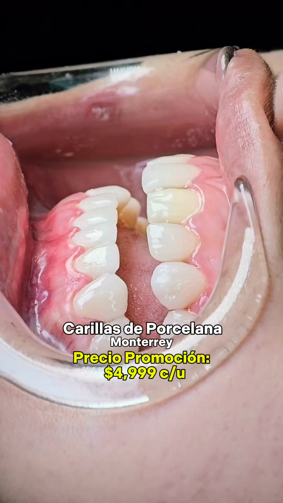 Diseño de Sonrisa Dr. Axel Navarro Facebook ad: Chatea con nosotros