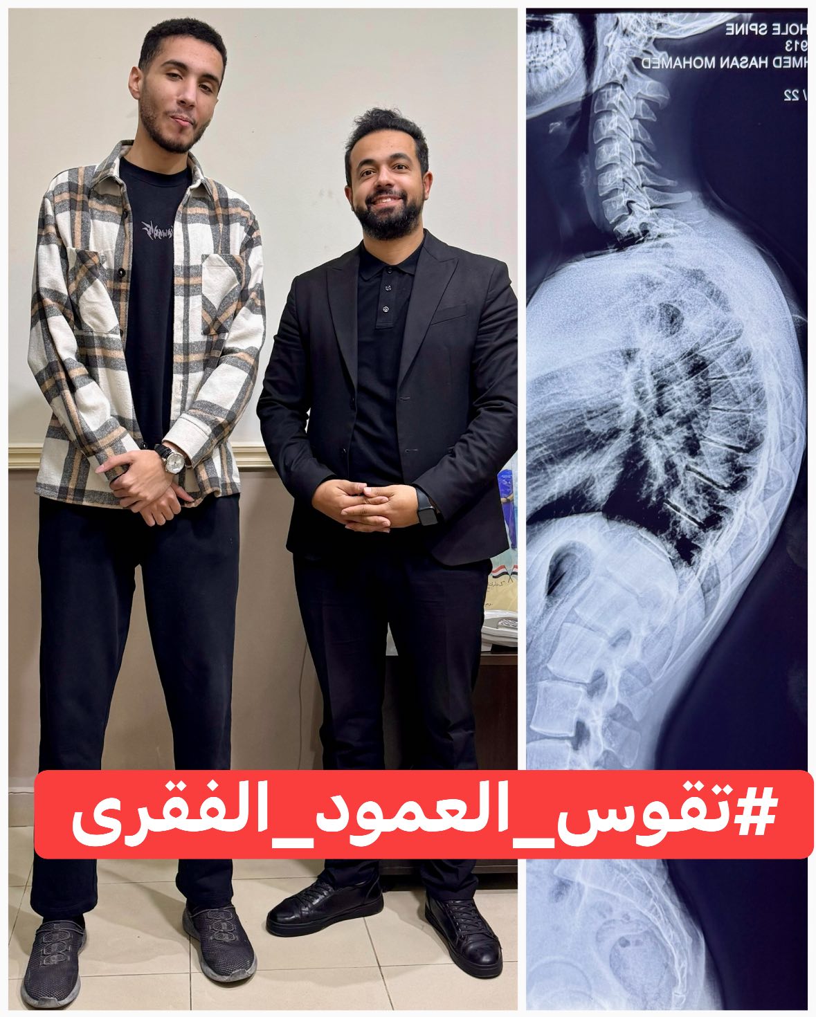 Dr. Ahmad Salama - INSC المركز الدولى لجراحة العمودالفقرى د.أحمد سلامه Facebook ad: يبان فى الصوره انى قصير.