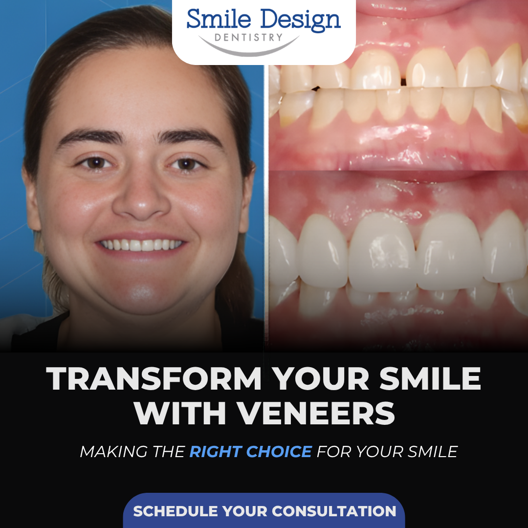 Smile Design Dentistry Facebook ad