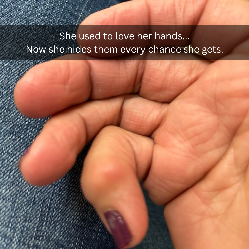The Menopause Journal Facebook ad: Menopause did this to her hands
