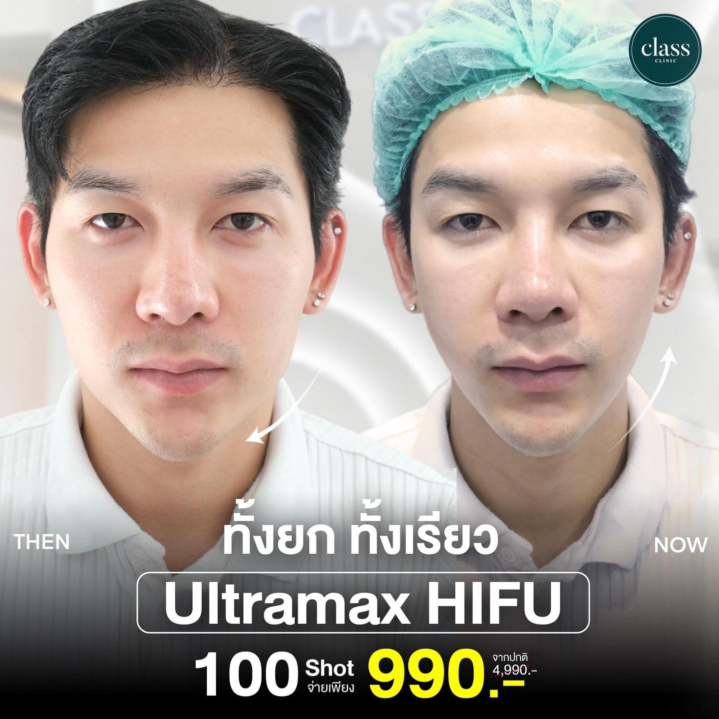 Class Clinic KR. - คลาสคลินิก โคราช Facebook ad: ทั้งยกทั้งเรียว เครื่องเดียวเอาอยู่