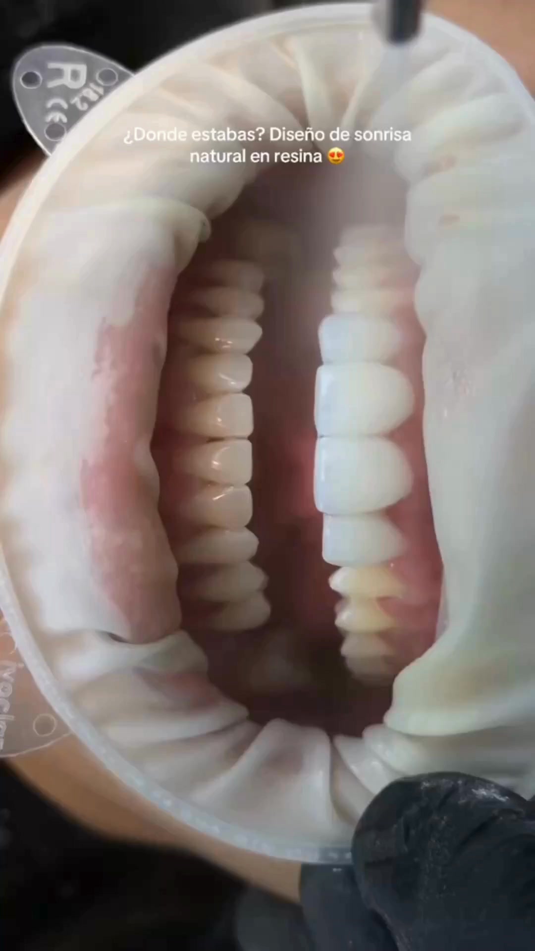 Dr. Gabriel Díaz Facebook ad: Diseño de sonrisa sin desgaste dental