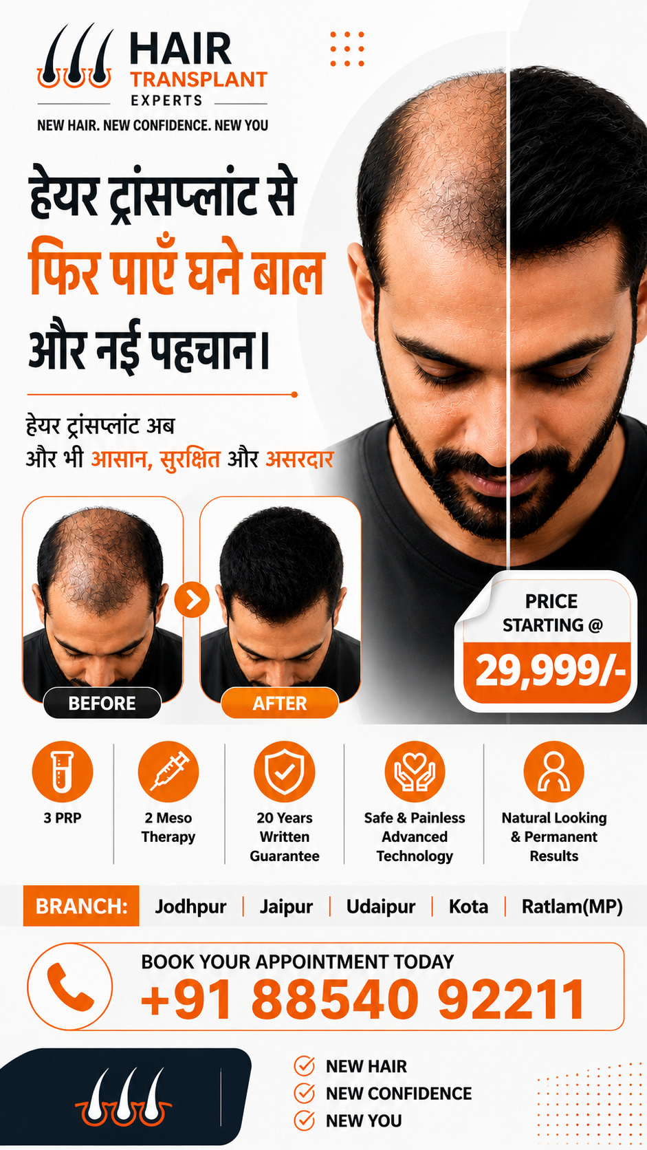 Best hair Transplant in Rajsthan-Udaypur-Kota,Jodhpur,Jaipur Facebook ad