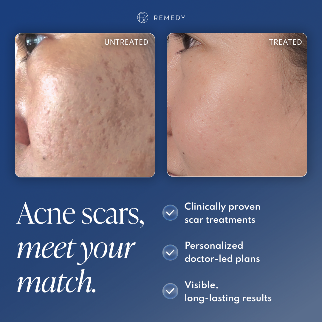 Remedy Skin Solutions Facebook ad