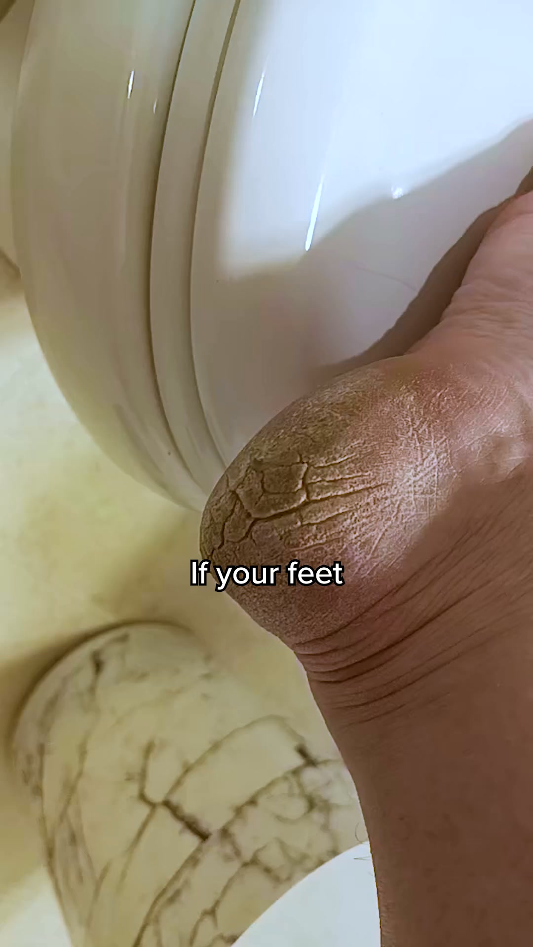Nuvé Facebook ad: Baby soft feet in 5 minutes flat